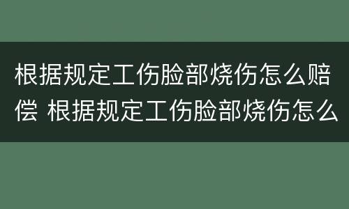 根据规定工伤脸部烧伤怎么赔偿 根据规定工伤脸部烧伤怎么赔偿的
