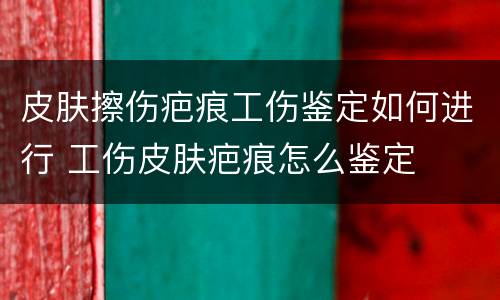 皮肤擦伤疤痕工伤鉴定如何进行 工伤皮肤疤痕怎么鉴定